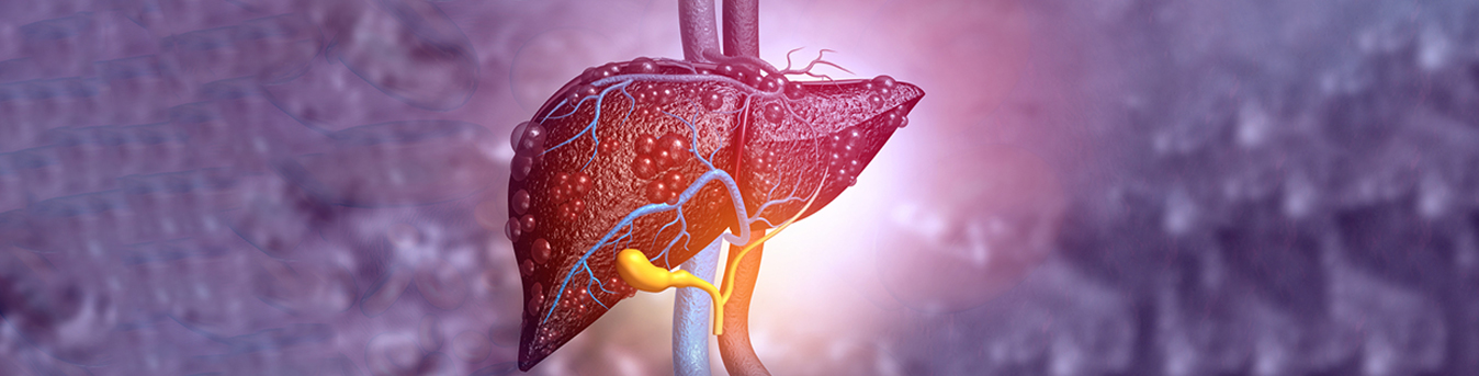 Liver cirrhosis and some lesser-known facts about it